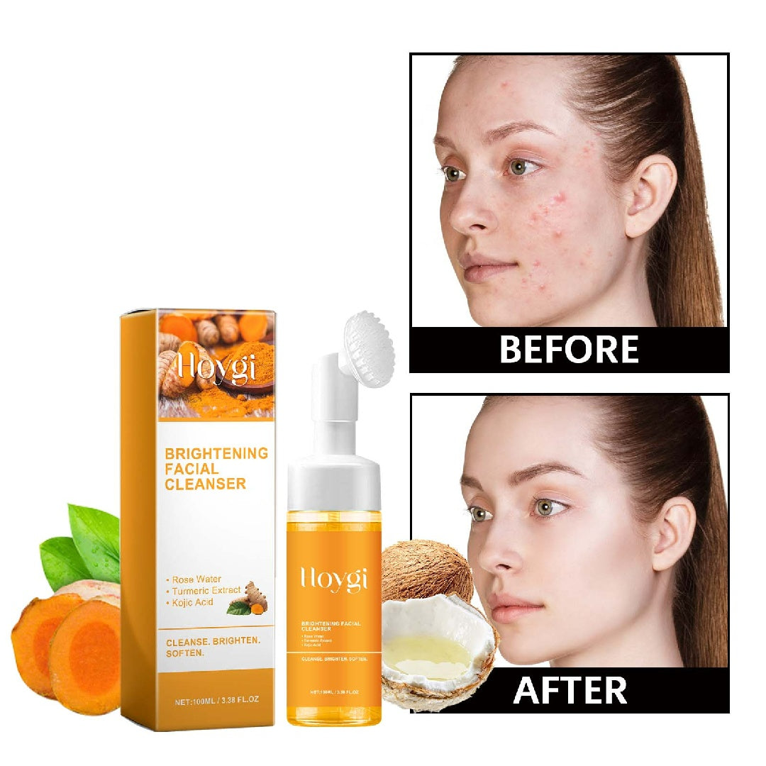 Turmeric Facial Cleanser Deeply Cleanses The Facial Skin, Fades Acne Marks And Acne Marks, And Moisturizes, Brightens And Beautifies The Skin